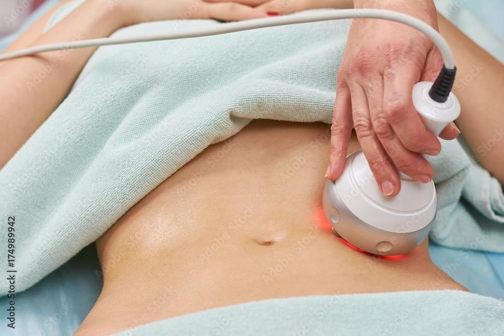 Ultrasonic Cavitation