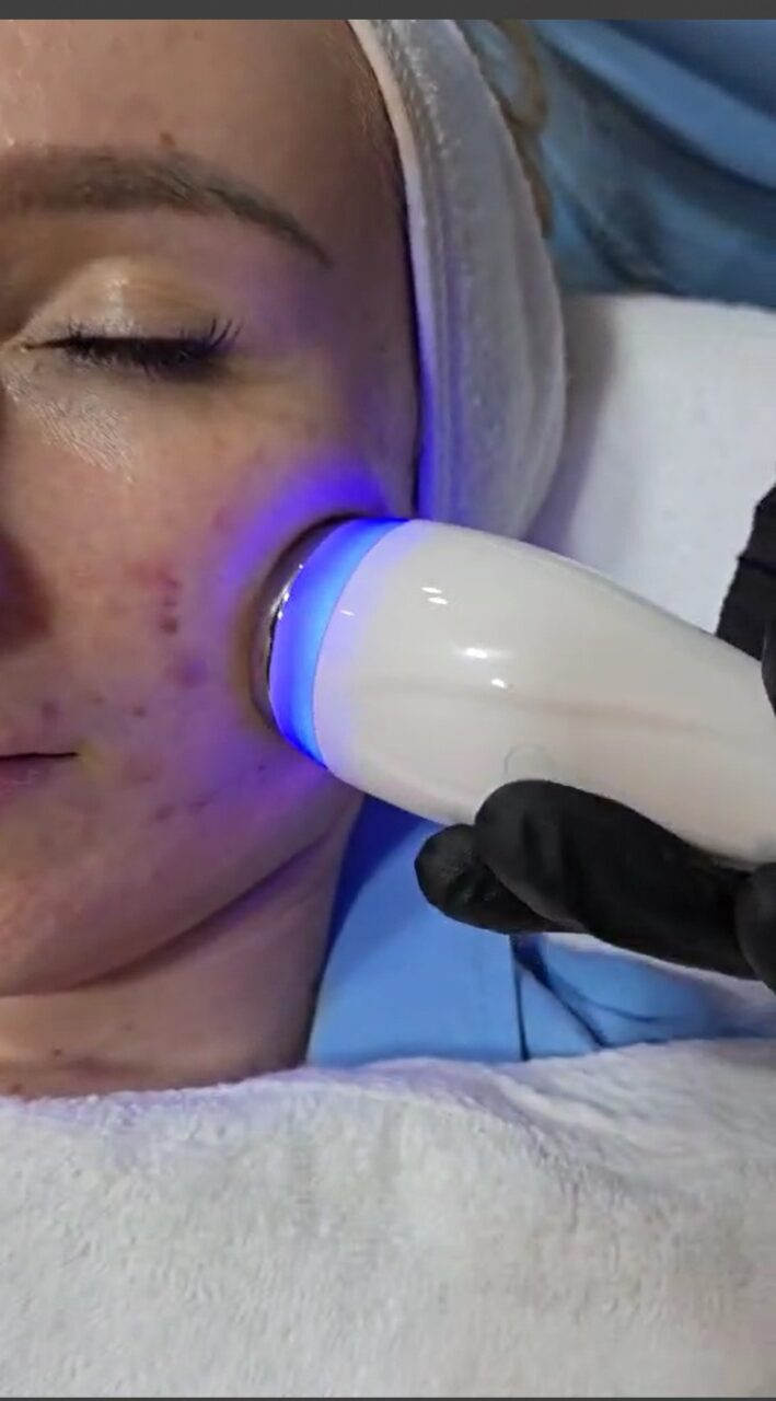 Fusion Jet Plasma Cold